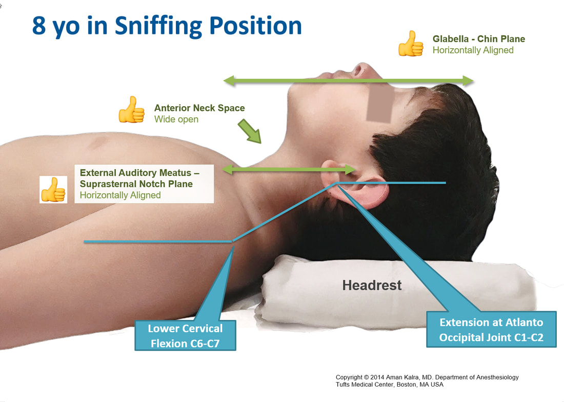 Positioning Infants and Children for Airway Management - Pediatric